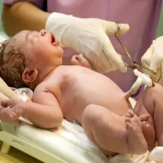 Nowy maminsynek płacze, gdy lekarz przecina mu pępowinę.